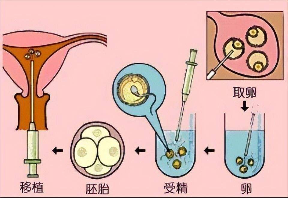 靠谱的专业公司！上海试管供卵宝宝价格“哪里便宜”-第1张图片-依高网